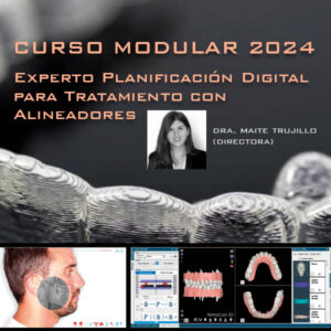 Planificación Alineadores