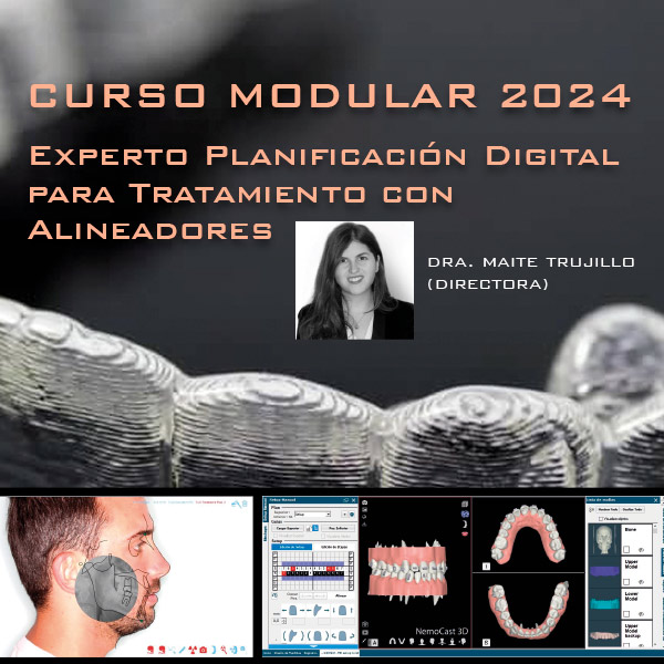 Planificación Alineadores Planificación Alineadores