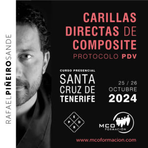 Carillas Directas de Composite Santa Cruz de Tenerife 2024